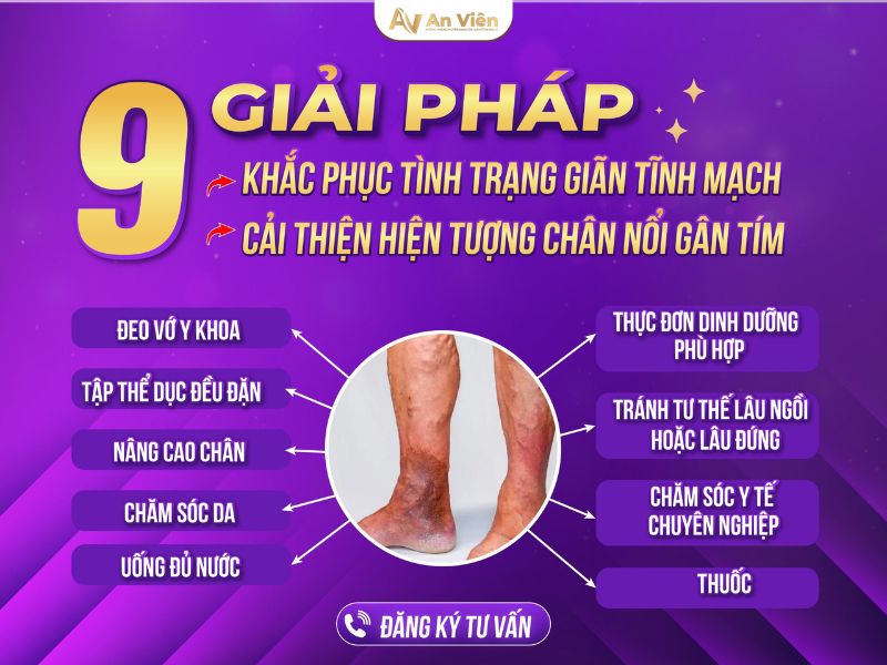 chân nổi gân tím
