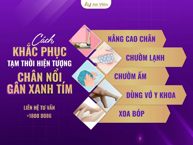 chân nổi gân xanh tím