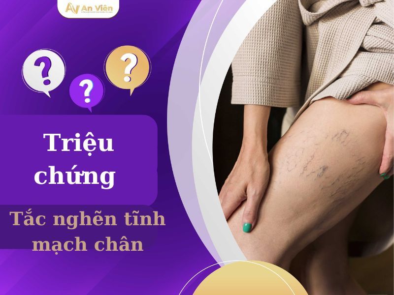 chữa viêm tắc tĩnh mạch chi dưới
