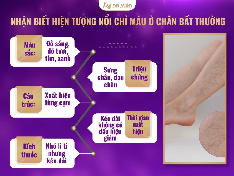 nổi chỉ máu ở chân