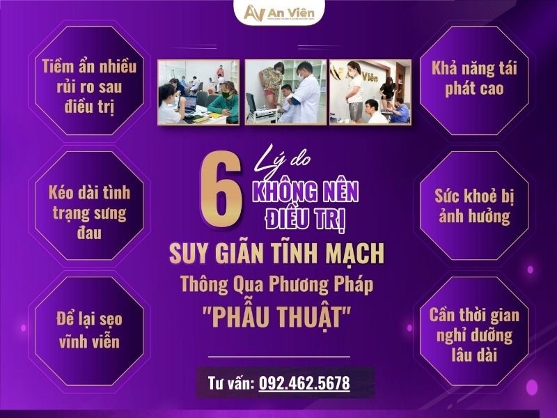phẫu thuật giãn tĩnh mạch chân