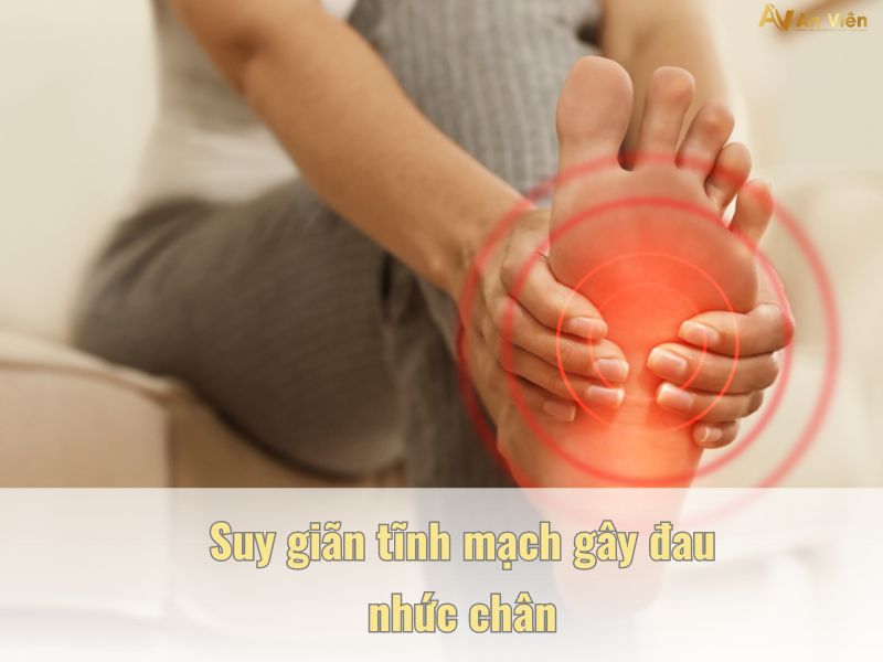 suy giãn tĩnh mạch có nguy hiểm không