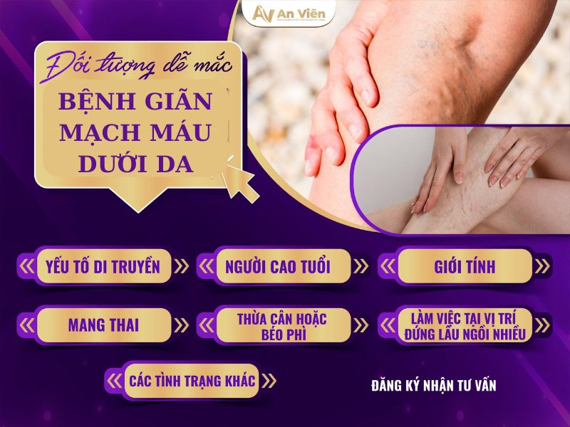 bệnh giãn mạch máu dưới da