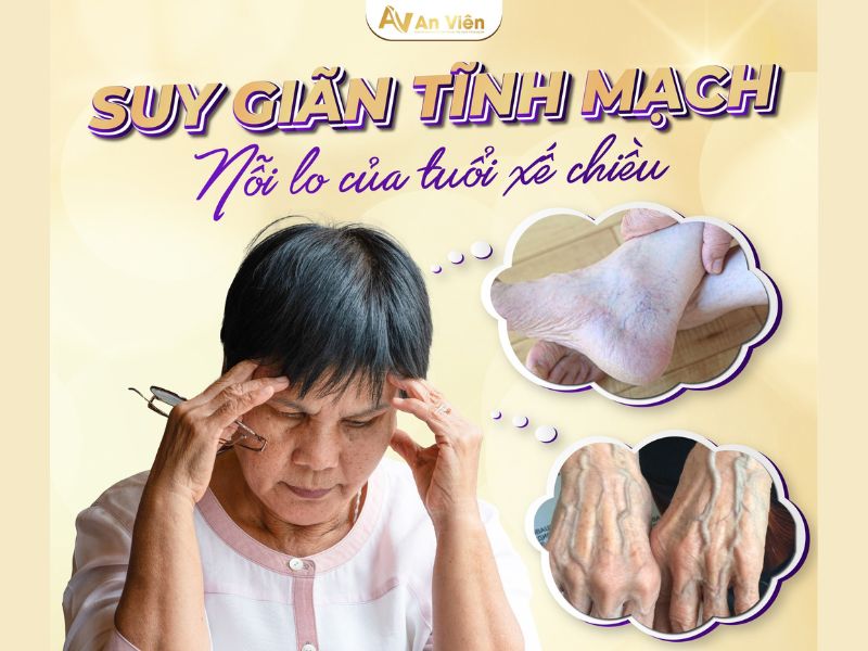 Bệnh giãn mạch máu dưới da