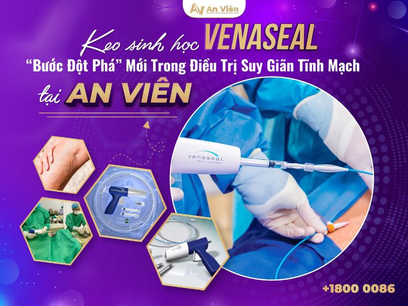 cách điều trị huyết khối tĩnh mạch