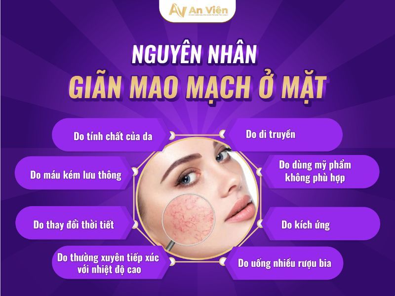 cách làm mờ mạch máu trên da mặt