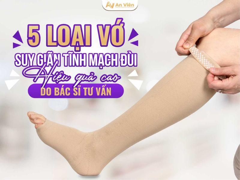 giãn tĩnh mạch nông chi dưới