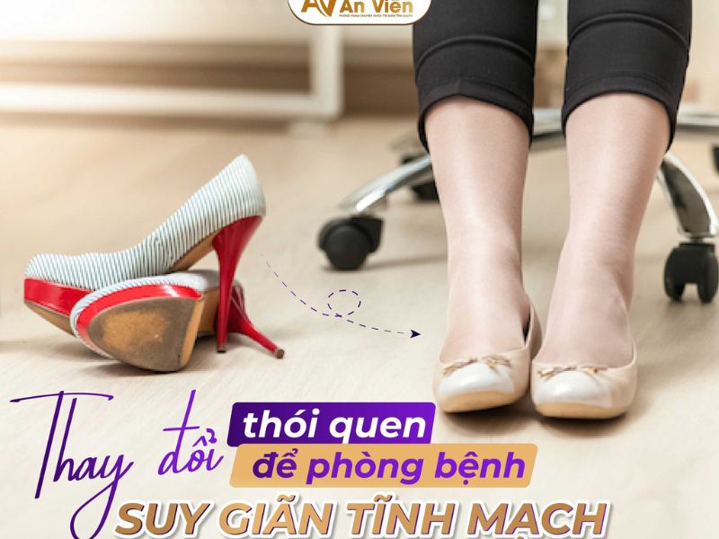 giãn tĩnh mạch nông chi dưới
