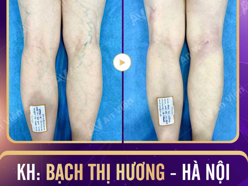 phòng khám an viên nha trang