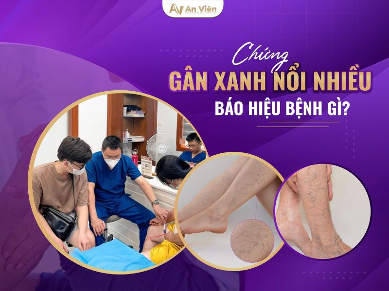 phòng khám tĩnh mạch Nha Trang 
