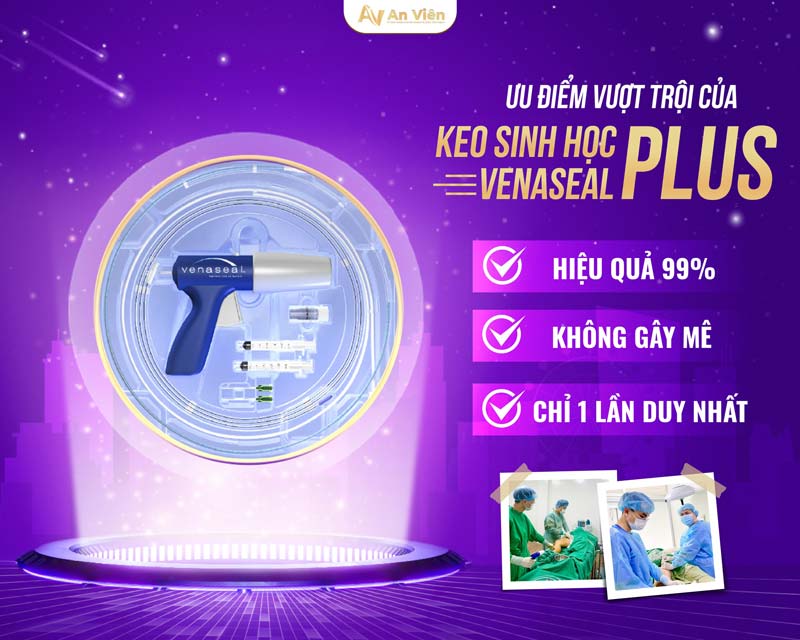 phồng tĩnh mạch chân 1