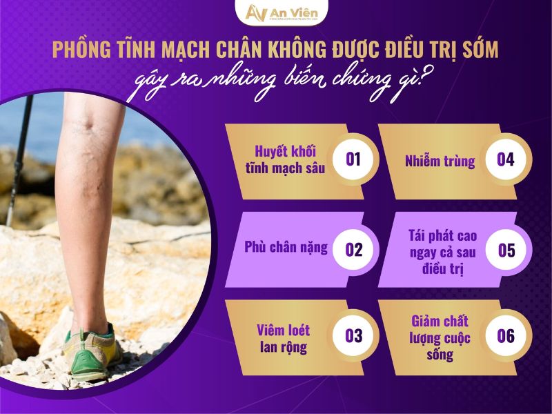 phồng tĩnh mạch chân