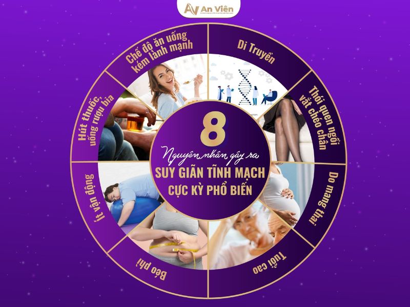 trị giãn tĩnh mạch chân