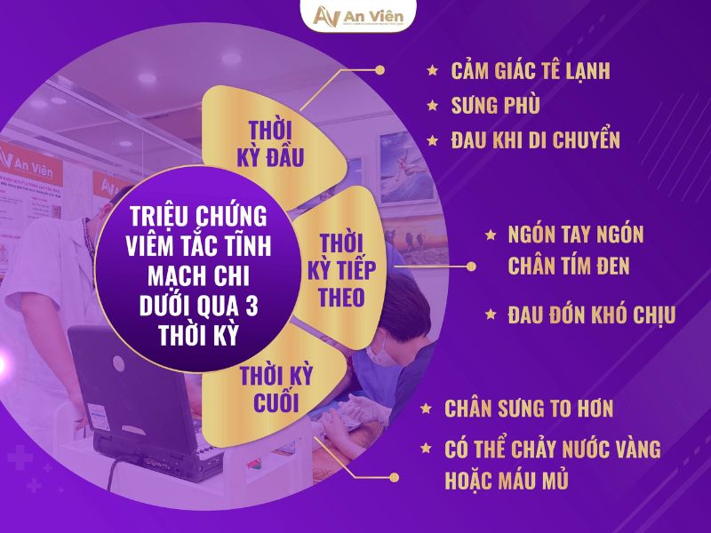 viêm tĩnh mạch chi dưới