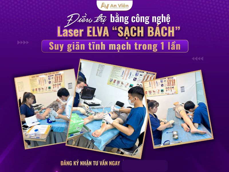viêm tĩnh mạch chi dưới