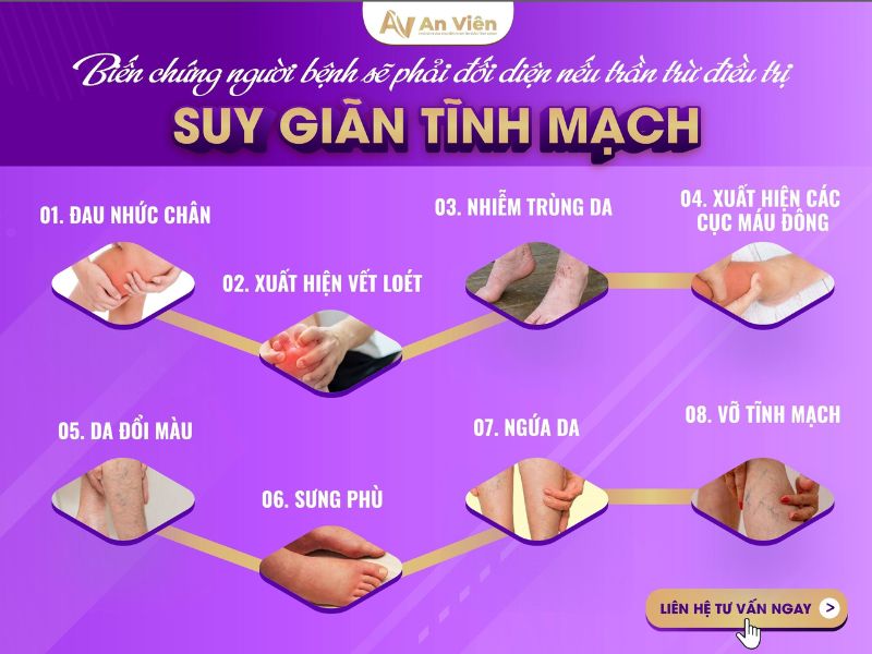 bệnh suy giãn tĩnh mạch có nguy hiểm không