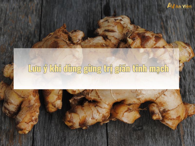 cách điều trị suy giãn tĩnh mạch tại nhà