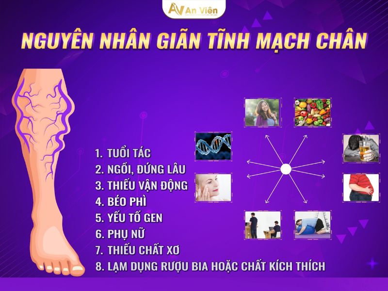 cách ngăn ngừa giãn tĩnh mạch