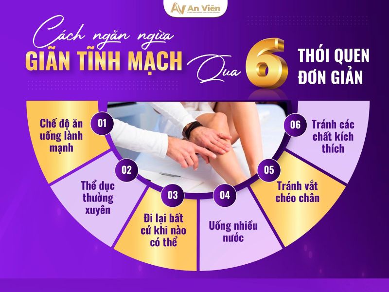 cách ngăn ngừa giãn tĩnh mạch