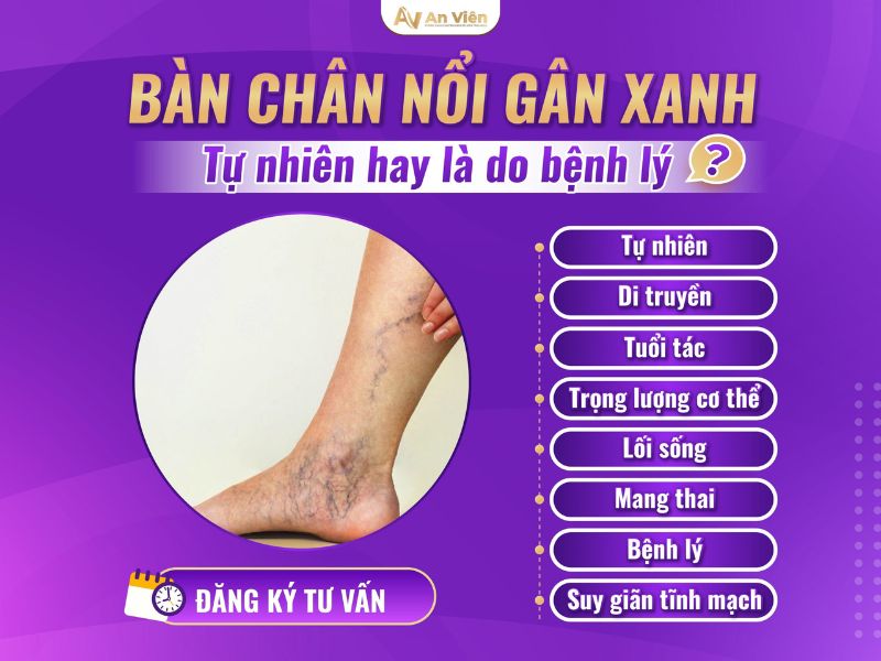 chân nổi gân xanh là bệnh gì