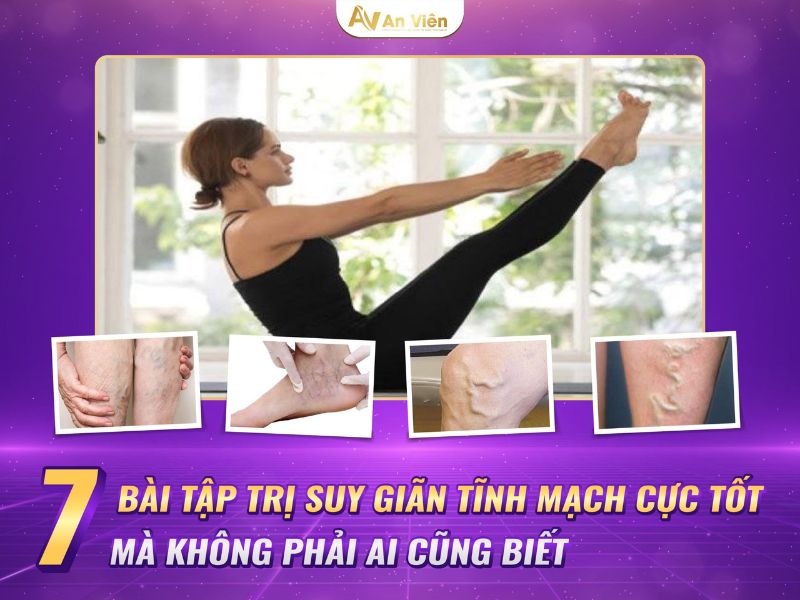 chân nổi gân xanh là bệnh gì