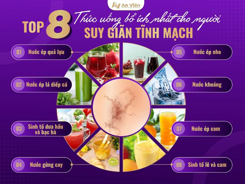 chữa bệnh suy giãn tĩnh mạch