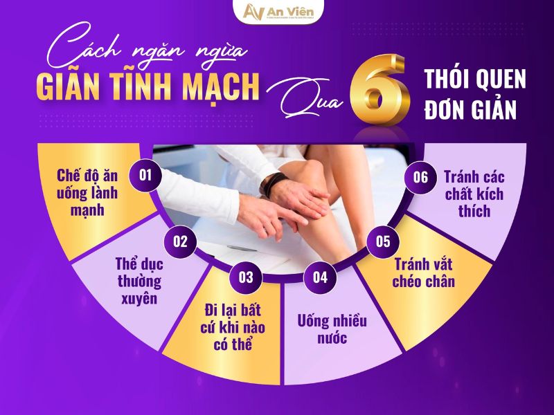giãn tĩnh mạch chân có nguy hiểm không