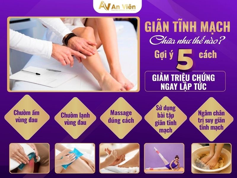 giãn tĩnh mạch chườm nóng hay lạnh