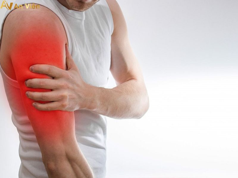 giãn tĩnh mạch ở bắp tay