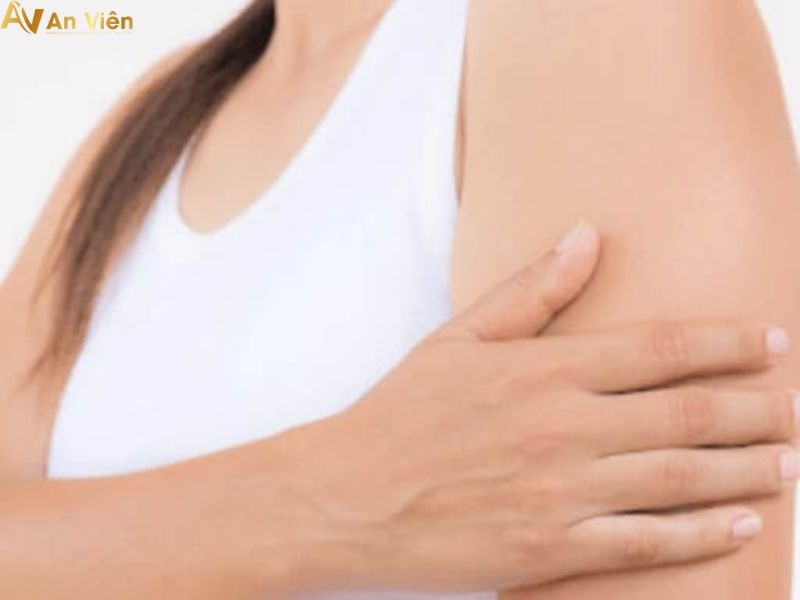 giãn tĩnh mạch ở bắp tay