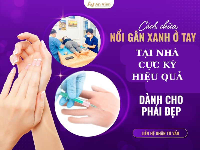 giãn tĩnh mạch ở bắp tay