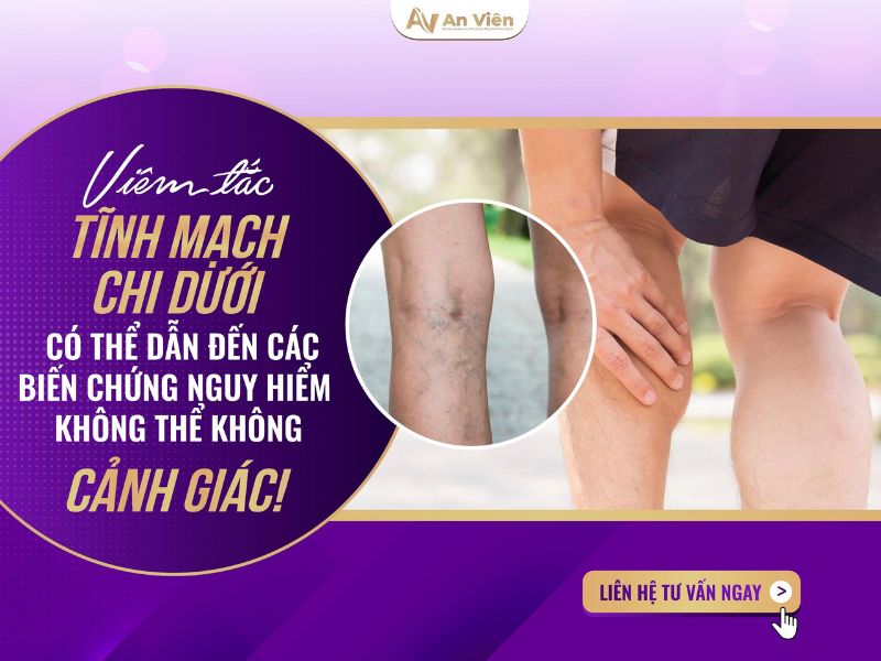 phác đồ điều trị viêm tắc tĩnh mạch chi dưới