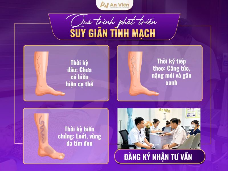 phác đồ điều trị viêm tắc tĩnh mạch chi dưới