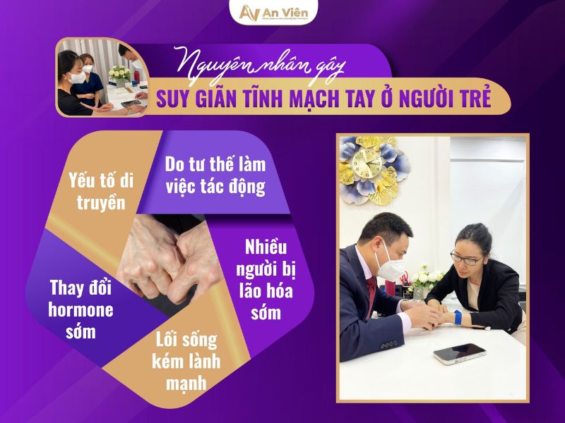 suy giãn tĩnh mạch tay