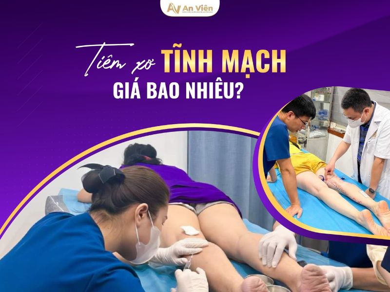 tiêm xơ giãn tĩnh mạch giá bao nhiêu