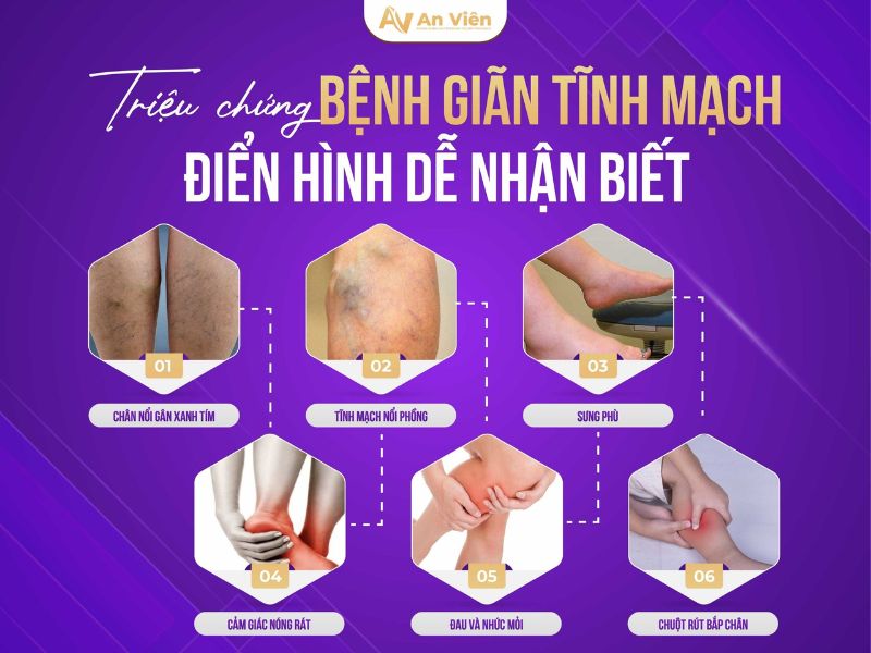 bệnh viện điều trị giãn tĩnh mạch