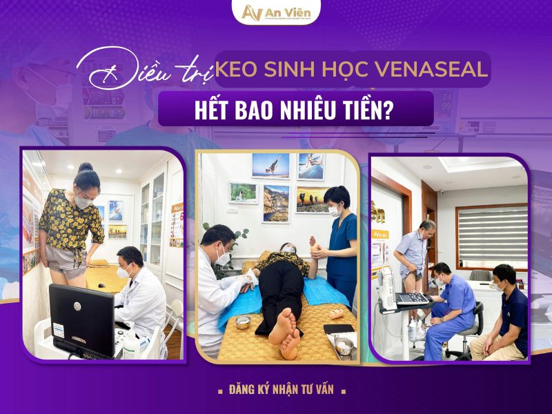 bệnh viện trị suy giãn tĩnh mạch