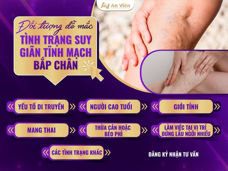 bị giãn tĩnh mạch ở chân phải làm sao