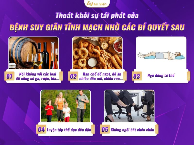 cách điều trị giãn tĩnh mạch chân tại nhà