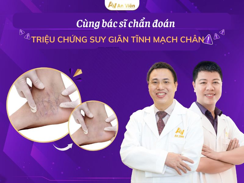 cách điều trị giãn tĩnh mạch chân tại nhà