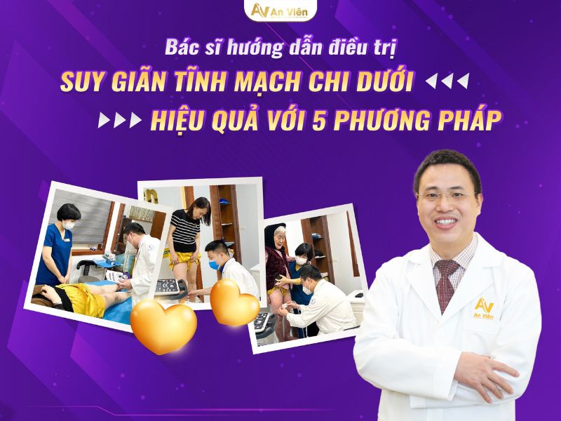 cách điều trị giãn tĩnh mạch chân tại nhà