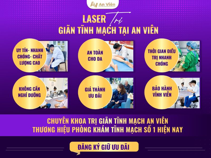 cách trị suy giãn tĩnh mạch