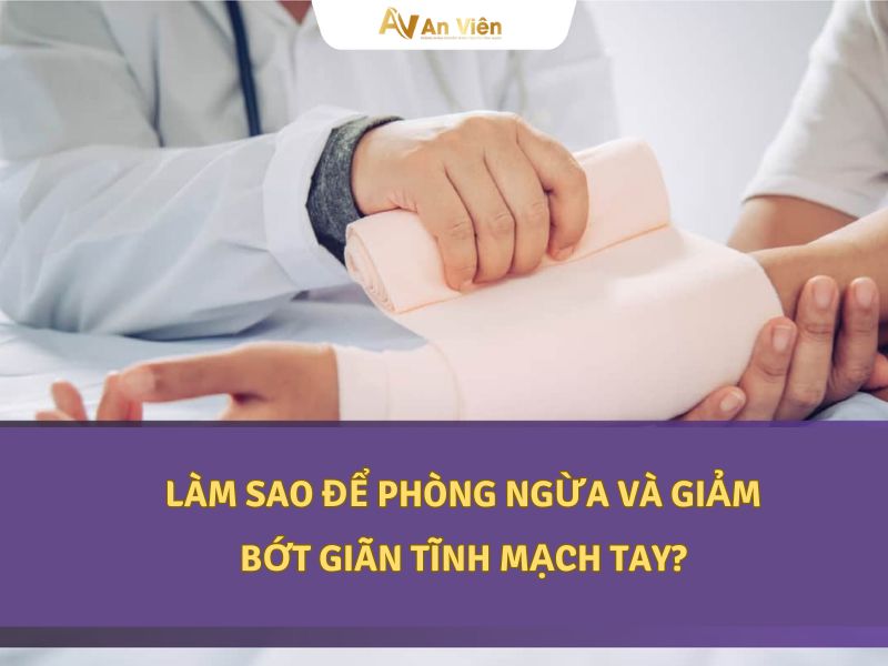 giãn tĩnh mạch tay