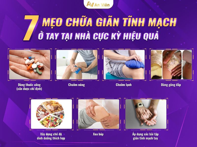 giãn tĩnh mạch tay