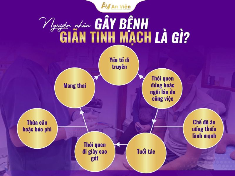 nguyên nhân giãn tĩnh mạch