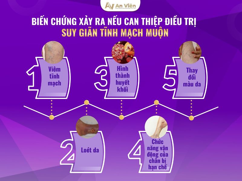 nguyên nhân giãn tĩnh mạch