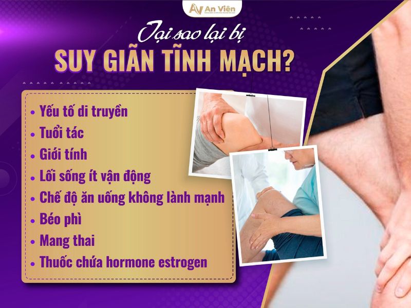 nổi gân máu ở chân