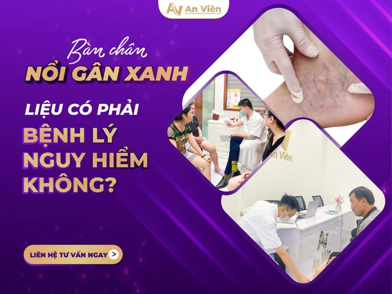 nổi gân máu ở chân
