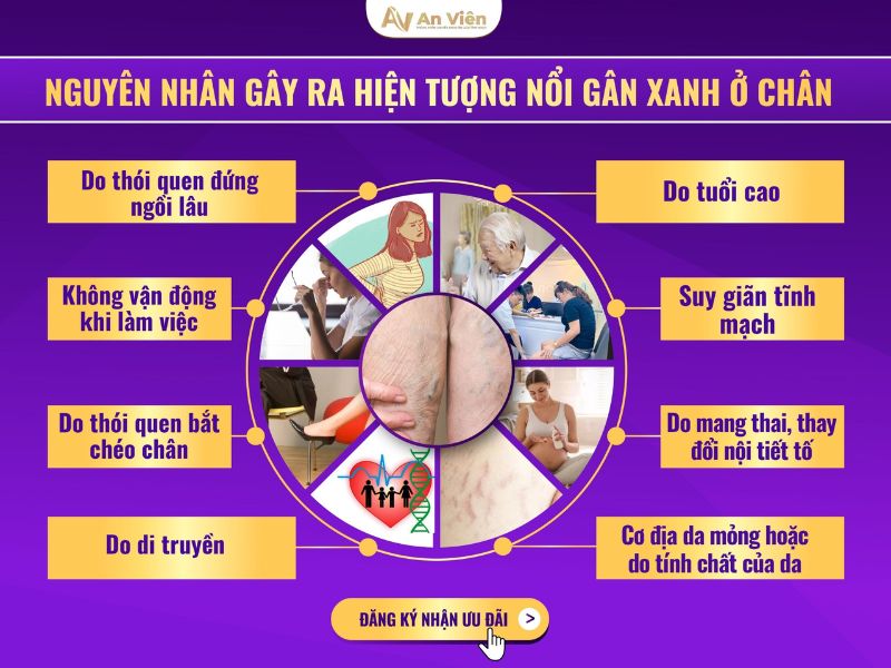 nổi mạch máu đỏ ở chân