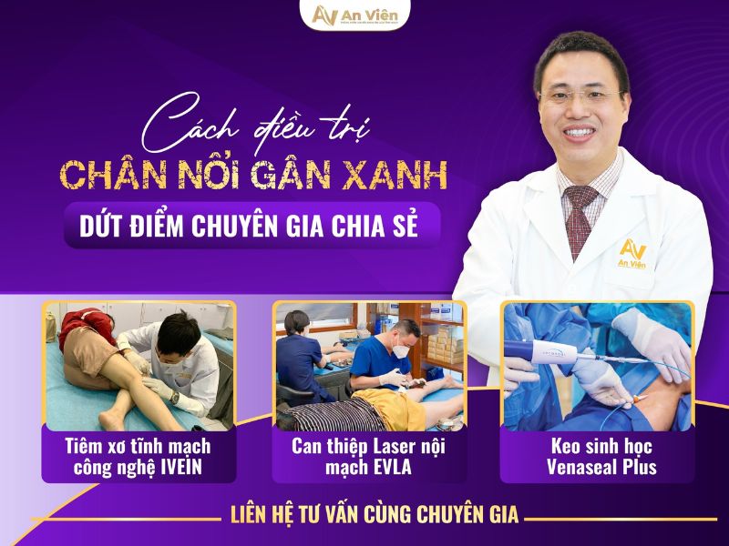 nổi mạch máu đỏ ở chân